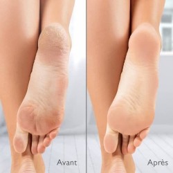 Râpe électrique anti-callosités Silk'n Vacupedi avec aspiration int