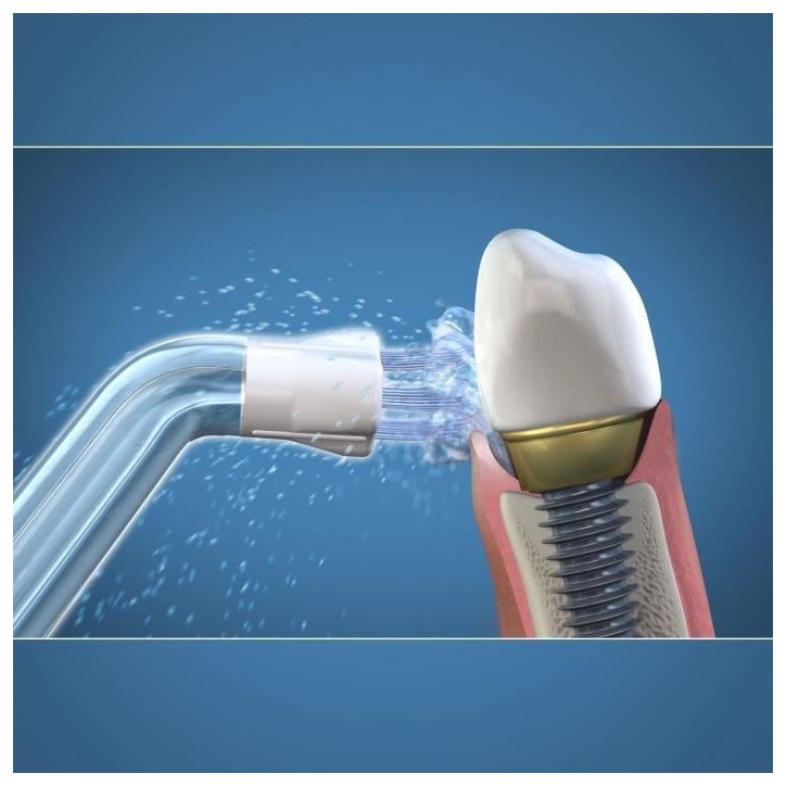 Embout Hydropulseur - WATERPIK - Plaque Seeker - Élimine la plaque