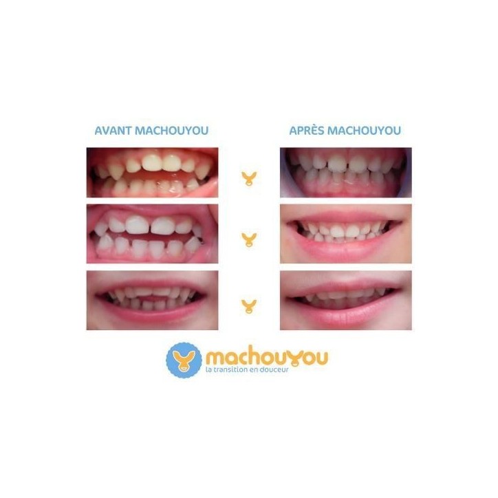 Machouyou Dispositif 1eres dents couleur - Orange