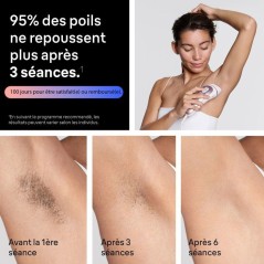 Épilateur a lumiere pulsée - BRAUN - Skin i-expert PL7431 - IPL - Ca