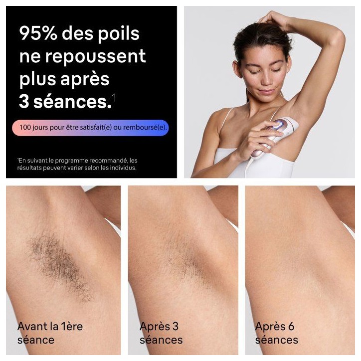 Épilateur a lumiere pulsée - BRAUN - Skin i-expert PL7431 - IPL - Capteur SkinProtect - Blanc et Rose gold Épilateur a lumiere pulsée - BRAUN - Skin i-expert PL7431 - IPL - Capteur SkinProtect - Blanc et Rose gold